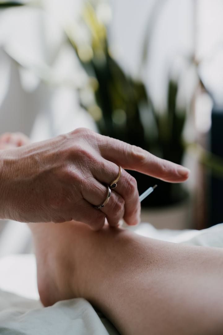 Dr. Brandee Goedecke treating a patient at Unity Acupuncture